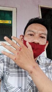 Liputan Mediasi Sengketa Tanah Awak Media Kena Keroyok